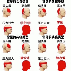一些常见的头痛类型